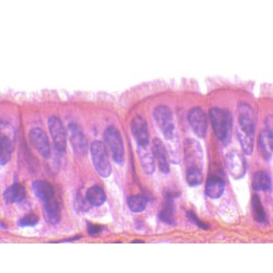 EPITELIO CILIADO, SEC.  