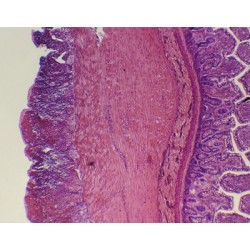 INTESTINO DELGADO, S.T.  