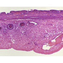 VESICULA BILIAR, SEC. 