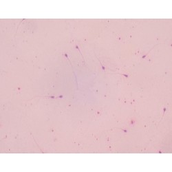 EXTENSION DE ESPERMA HUMANO  