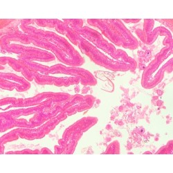 INTESTINO GRUESO DE RANA,...