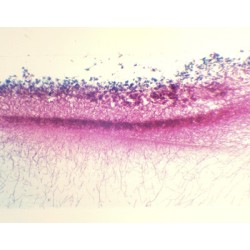 PENICILLIUM, M.E.  