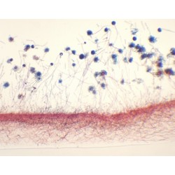 ASPERGILLUS, M.E. 