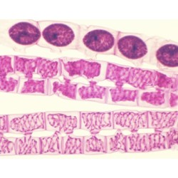 CONJUGACION DE SPIROGYRA,...