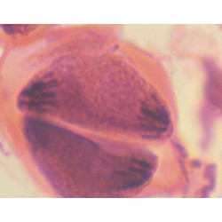 MEIOSIS, ANTERA DE LIRIO,...