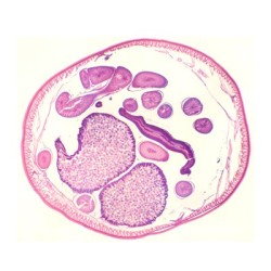 HEMBRA DE ASCARIS, S.T. 