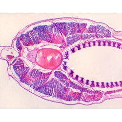 BRANCHIOSTOMA BELCHERI...