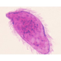 MIRACIDIO DE SCHISTOSOMA,...
