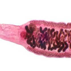 CLONORCHIS SINENSIS (DUELA...
