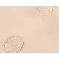 HUEVOS DE SCHISTOSOMA, M.E. 