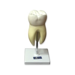 MOLAR SUPERIOR C/3 RAICES
