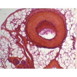 ARTERIA Y VENA, S.T.  