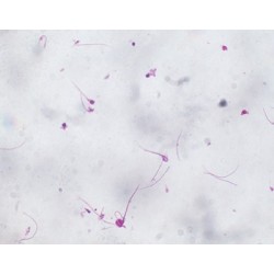 EXTENSION DE ESPERMA DE RANA 